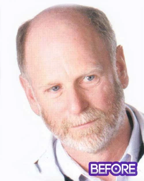 Oscar | Men's Hairpiece By Leading Man Toupee For Men 6 Oscar | Men's Hairpiece By Leading Man Toupee For Men